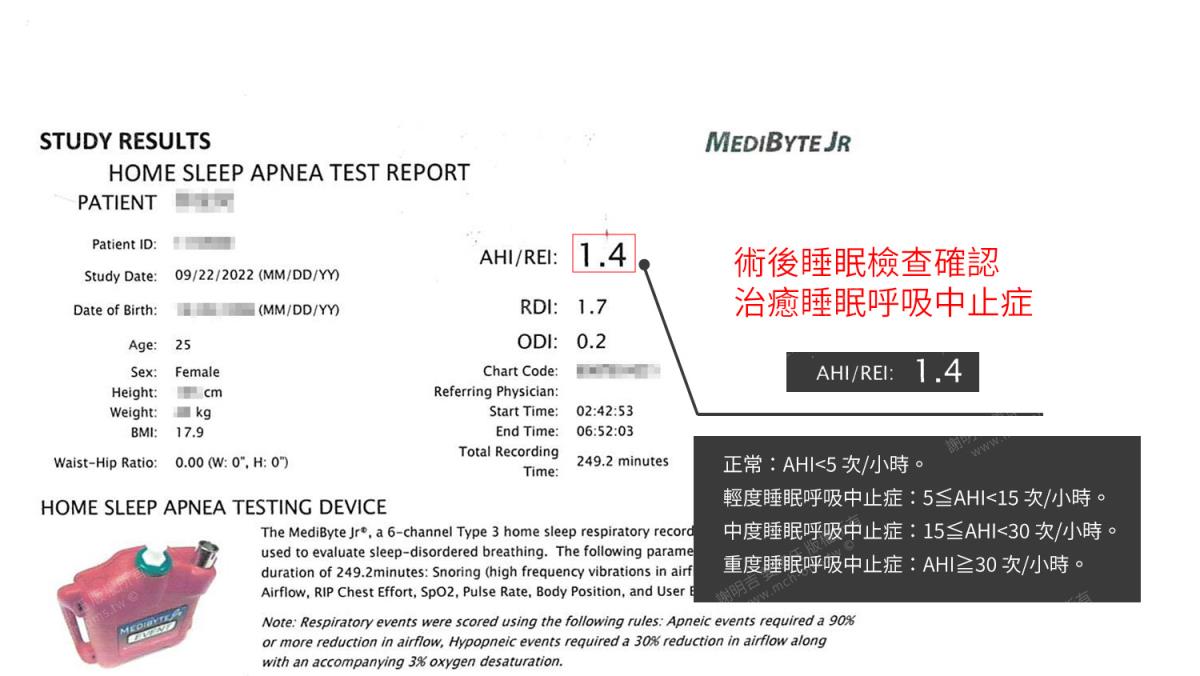 case14 12