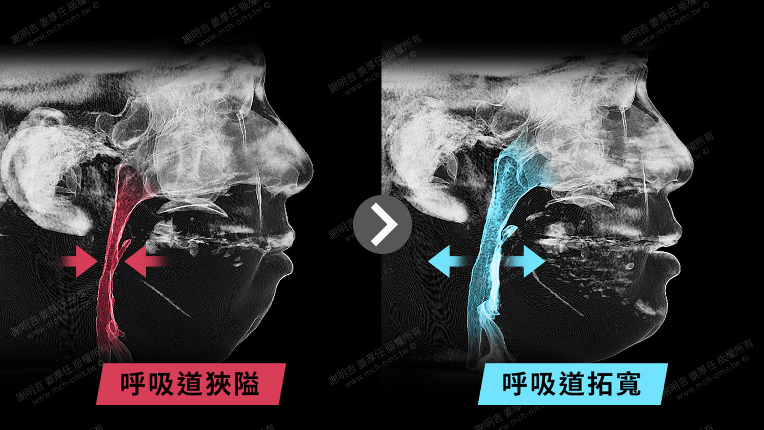 mma case 13 8